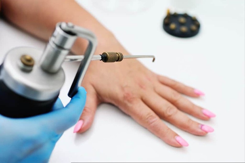 Các loại mụn cóc thường gặp và cách điều trị hiệu quả 4