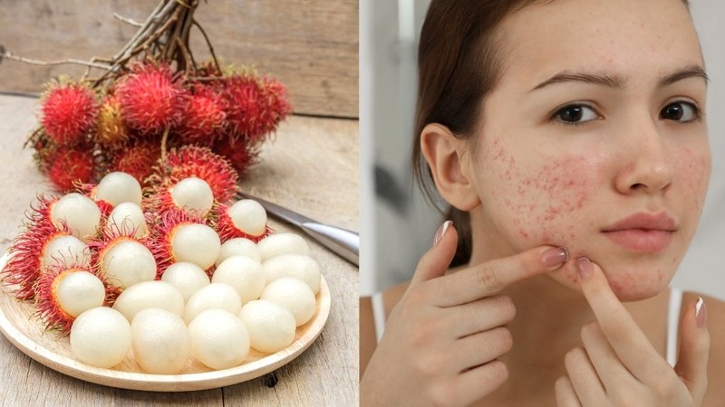 Biểu tượng cảnh báo sức khỏe liên quan đến việc ăn chôm chôm